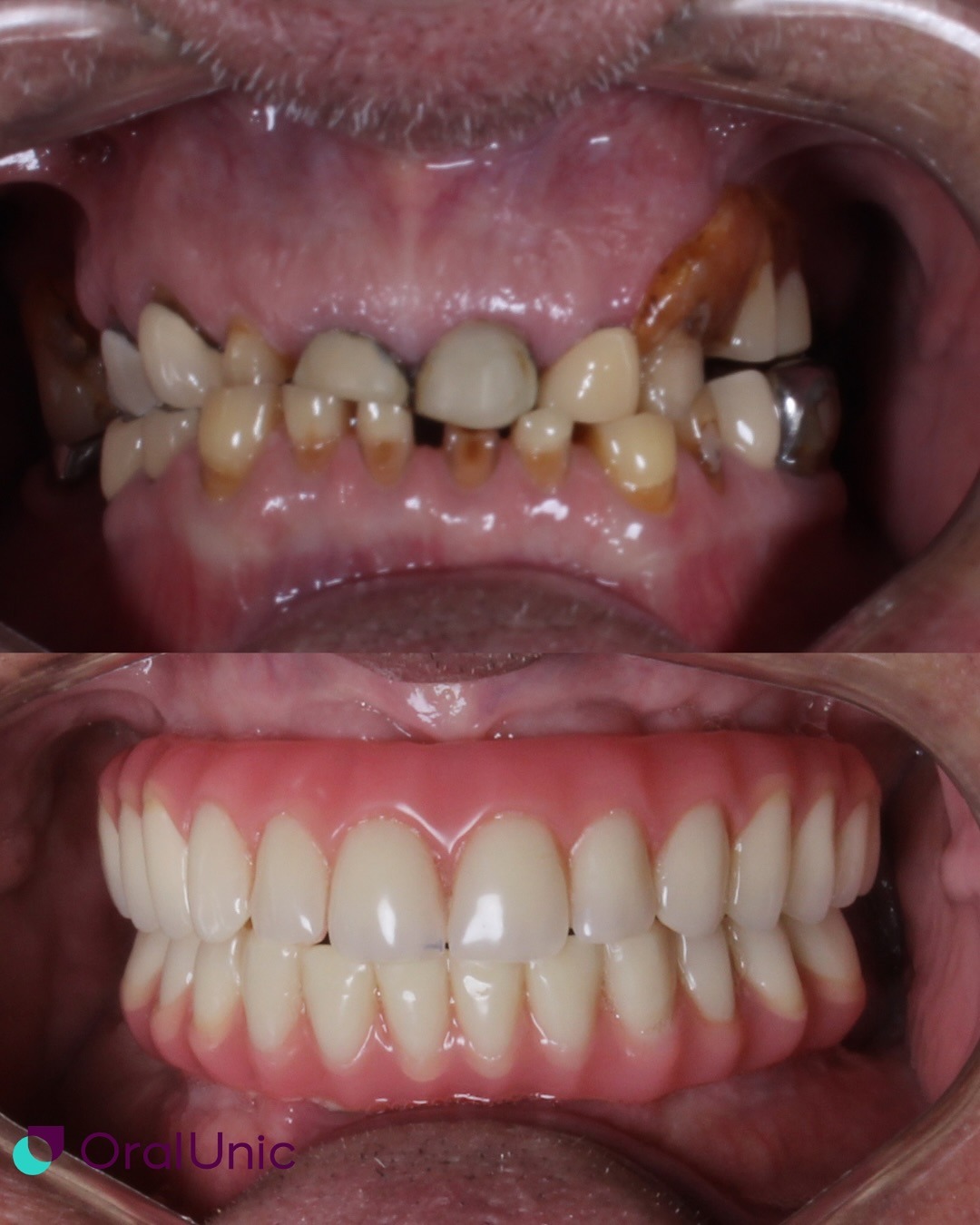 Resultado de tratamento odontologico Daldegan Odontologia Niteroi